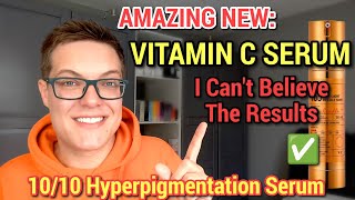 ULTIMATE HYPERPIGMENTATION SERUM  Next Level Korean Skincare Vitamin C [upl. by Adia]