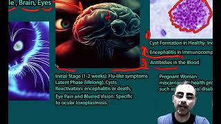 Toxoplasmosis  Symptoms causes treatment why toxoplasmosis so important in Pregnant women [upl. by Oicor]