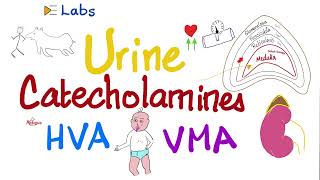 Catecholamines Epinephrine NoEpinephrine Dopamine Metanephrines HVA VMA  Pheochromocytoma [upl. by Couhp444]