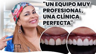 ¡Una Transformación de Sonrisa Increíble en Dental Estambul [upl. by Neddra]