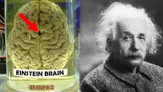 How Einsteins Brain was Different [upl. by Crescentia]