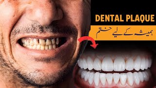 सिर्फ 2 मिनट में गंदे दांतों को मोती की तरह चमका देगा यह घरेलू नुस्खा Teeth Whitening Remedy [upl. by Anavrin240]