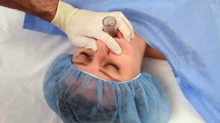 NuMask in Anesthesiology IntraOral Mask IOM®  Oropharyngeal Airway OPA Training Video [upl. by Davidson]