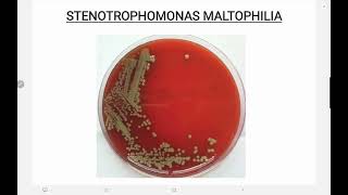 Stenotrophomonas maltophilia [upl. by Warms538]