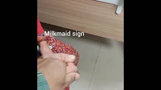 Milkmaid sign in patient with Huntington choreamedicine classroom [upl. by Iphigeniah]