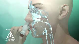 Fluticasone nasal spray Flonase  3D medical animation [upl. by Lyons]