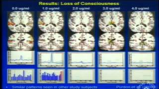 A Look at the Unconscious Brain Under General Anesthesia [upl. by Leahciam]