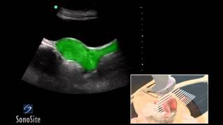 How To Female Pelvis Ultrasound Exam 3D Video [upl. by Jinny]