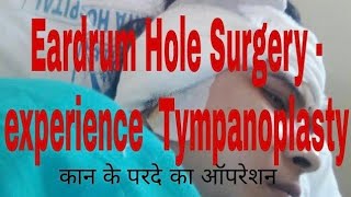 Eardrum Hole Surgery experience ear operation Tympanoplasty factsandmeinhindi [upl. by Onurb]