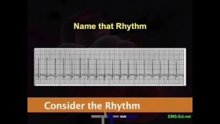 Intro EKG Interpretation Part 2 [upl. by Tippets]