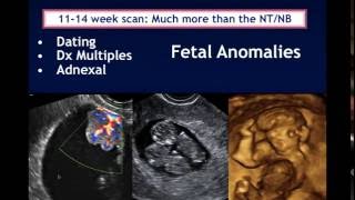 AIUM Webinar Systematic Evaluation of the 1114 Week Fetus Touching on ISUOG Guidelines [upl. by Eneleahs997]