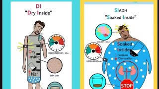 DIABETES INSIPIDUS MADE EASY FOR NCLEXRN nclex nursingincanada simplenursing canadausa [upl. by Tenay]