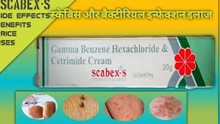 scabexs scabex s cream price scabex s cream for scabies scabex s cream benifits scabex s cream in [upl. by Amato]