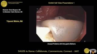 Unusual problems with intragastric balloons [upl. by Lauren]