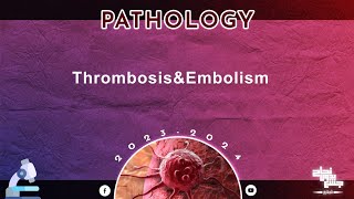 L14 Thrombosis and embolism Pathology [upl. by Hamimej]