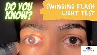 Swinging flash light test II How to examine RAPD II Assess relative afferent pupillary defect [upl. by Gregorio]