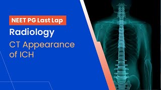 NEETPG Prep  Radiology  CT Appearance of ICH by Dr Abhishek Jha [upl. by Merriman111]