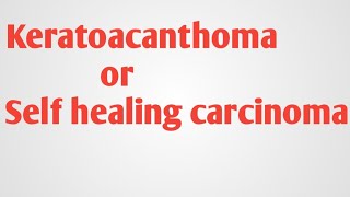 Keratoacanthoma or self healing carcinoma [upl. by Esahc]