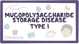 Mucopolysaccharide Storage Disease Type I Hurler HurlerScheie and Scheie syndromes [upl. by Len938]