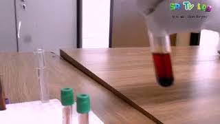 What is hemolysis hemolysis experiment using water [upl. by Lexy]