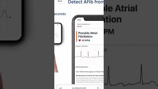 YOUR PORTABLE EKG COMPANION  KARDIAMOBILE 1  AMAZON FINDS ❤️ [upl. by Rania]