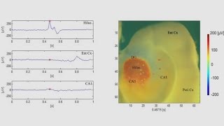 Propagating epileptiform activity in mouse corticohippocampal slices [upl. by Esahc]