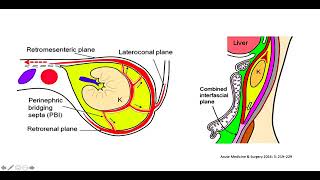 Anatomia do Retroperitônio [upl. by Eirotal409]