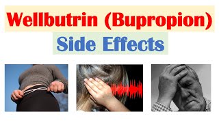 Wellbutrin Bupropion Side Effects To Watch Out For amp Why They Occur [upl. by Llehcor139]