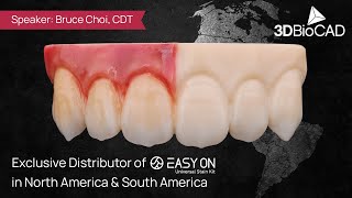 Aesthetics on Full Zirconia Cases with Easy On Stain Kits by Bruce Choi CDT [upl. by Okiruy442]