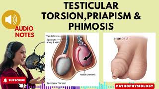 Testicular Torsion Priapism and PhimosisParaphimosis [upl. by Refenej]