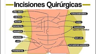 🔴 INCISIONES QUIRURGICAS ABDOMINALES [upl. by Harutak107]