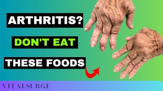 9 Foods To Avoid for Arthritis Stop Now [upl. by Yelsek]