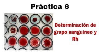 Práctica 6 Determinación de grupo sanguíneo y Rh [upl. by Ahsinor]