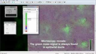 Intraportal Transplantation of Pancreatic Islets  Protocol Preview [upl. by Decca601]