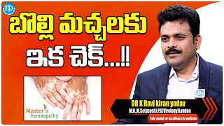 Treatment For Vitiligo Spots  DrkRavi Kiran Yadav  Masters Homeopathy  iDream Media [upl. by Nitsruk94]