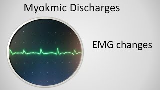 Myokymia on EMG [upl. by Tench365]