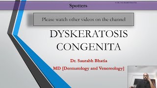 Dyskeratosis Congenita [upl. by Quiteri]