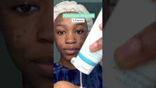 MDacne  Custom Acne Treatment  Get Your First Kit Free [upl. by Ibed]