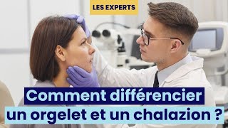 Comment différencier un orgelet et un chalazion  👀 [upl. by Naellij]