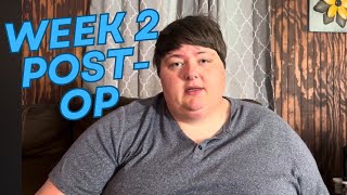 Gastric sleeve surgery  2 weeks post op [upl. by Mya]