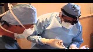 Dr Rizk Explains Septoplasty Surgery [upl. by Searby]