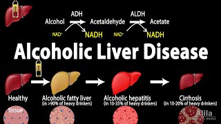 Alcoholic Liver Disease Animation [upl. by Grewitz213]