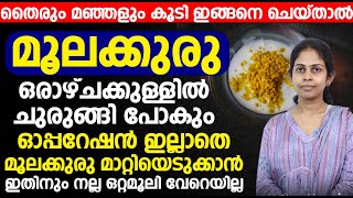 ഓപ്പറേഷൻ ഇല്ലാതെ മൂലക്കുരു മാറ്റിയെടുക്കാൻ ഇതിനും നല്ല ഒറ്റമൂലി വേറെയില്ല [upl. by Arik807]