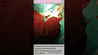 Myomectomy surgery gynecologist Myomectomy is surgery to remove uterin fibroid azamgarh otwithdr [upl. by Tlok630]