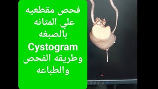 فحص Cystogram او اشعة بالصبغة علي المثانة علي جهاز مقطعيه GE [upl. by Nivrad497]