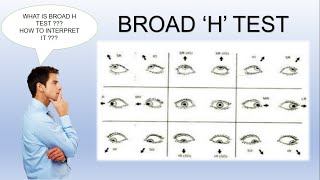 Broad H Test  Ocular Motility Test [upl. by Siocnarf]