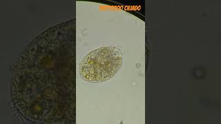 Oxytricha visto a 400X microscope protozoa cilliate [upl. by Giarc]