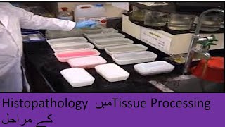 tissue processing in histopathology lab [upl. by True393]