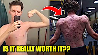 A 20yr Old Idiot Takes Steroids amp This Happens [upl. by Teddie25]