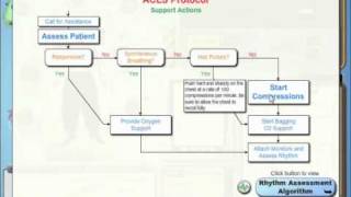 SimCode ACLS™  Asystole Tutorial [upl. by Yntruoc]